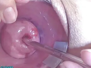 Rubbing that pussy until her uterus gets inflated by herself